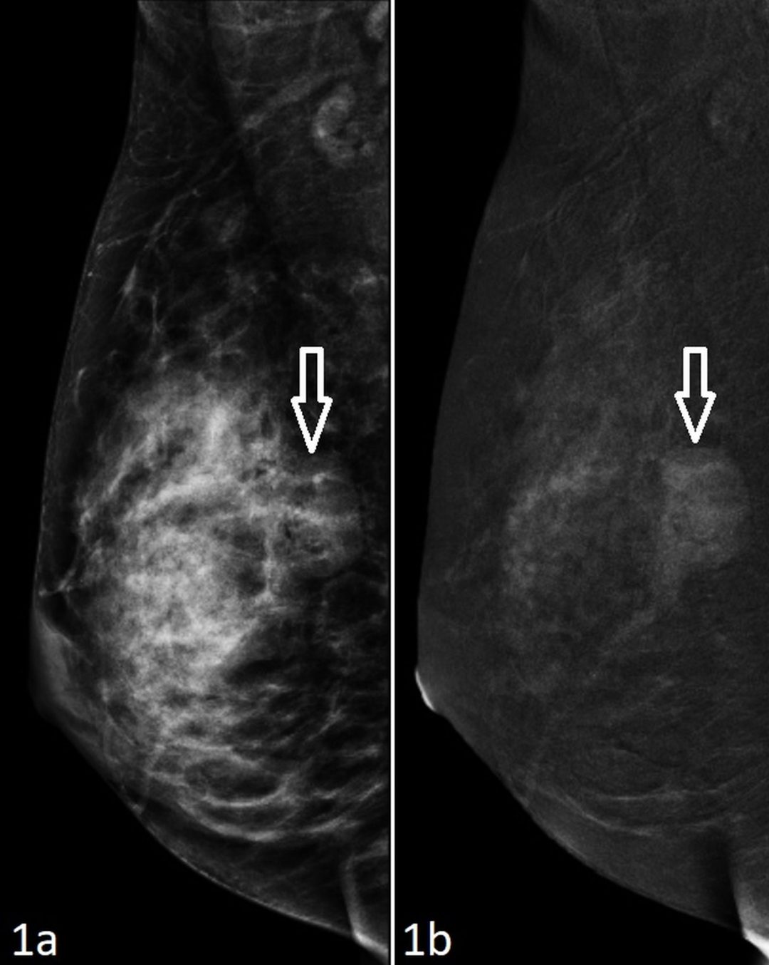 Figure 1a-1b - Insights into Imaging